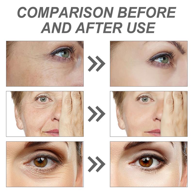 Retinol Anti-Falten Gesichtsse – The Ordinary Serum Hyaluronic Acid Bewertung und Preis